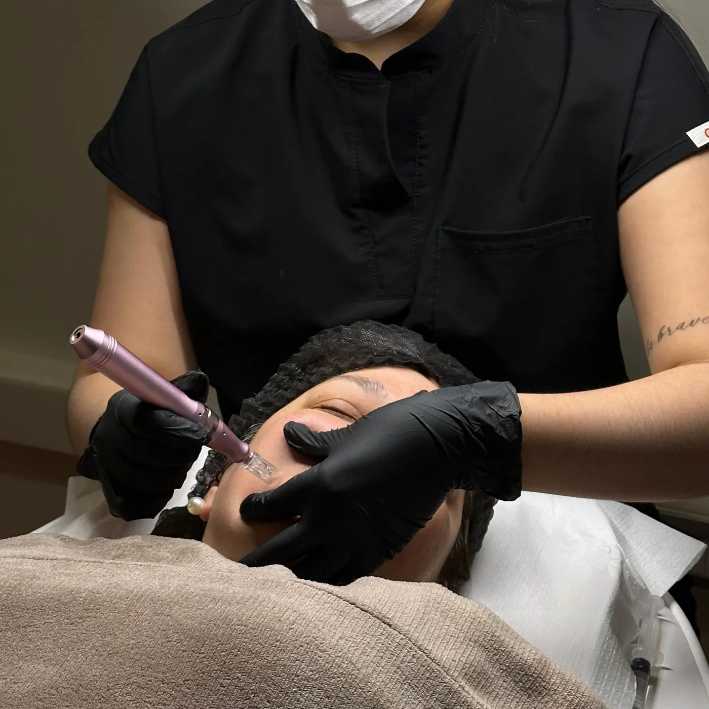 Pack 3 sesiones microneedling
