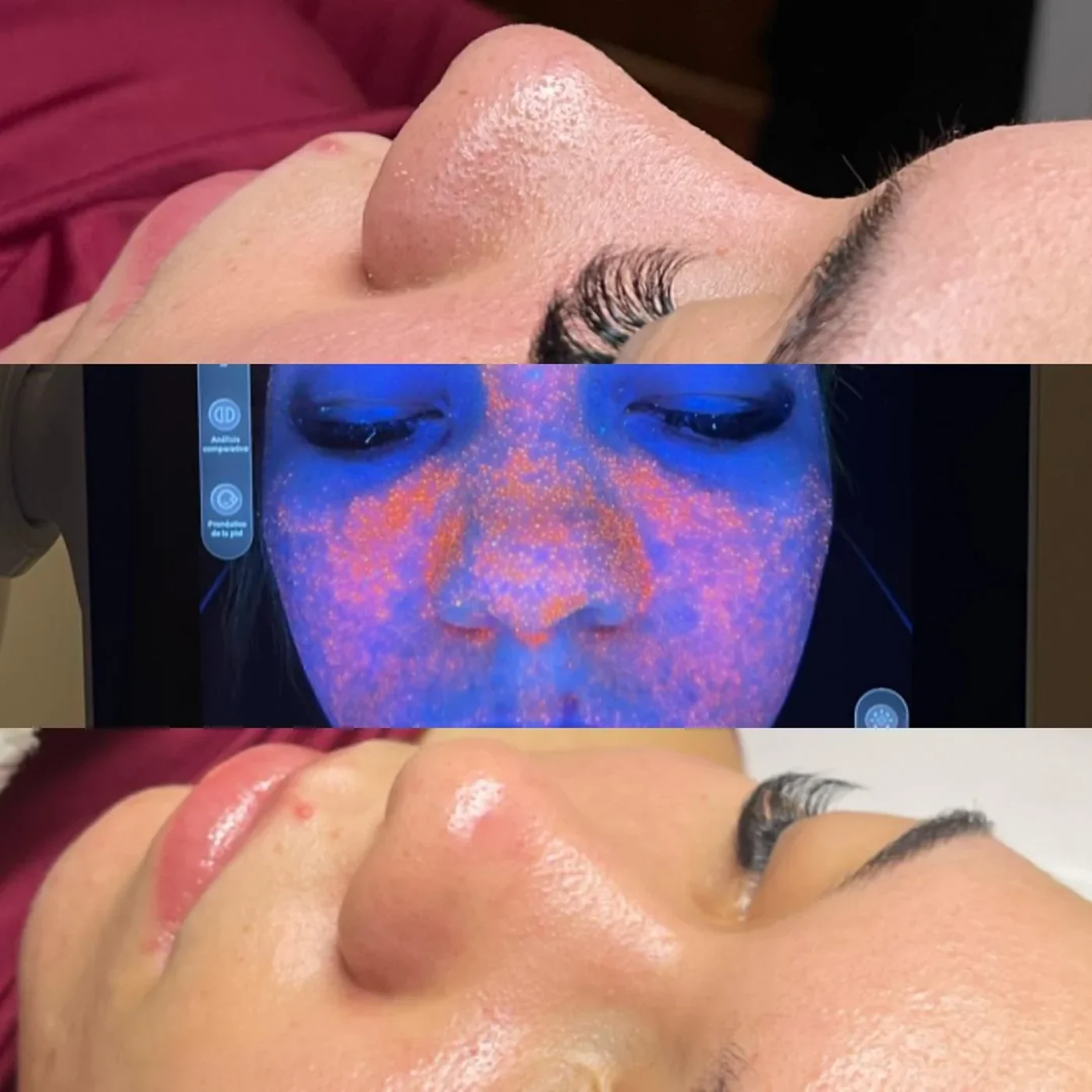 Limpieza facial Detox