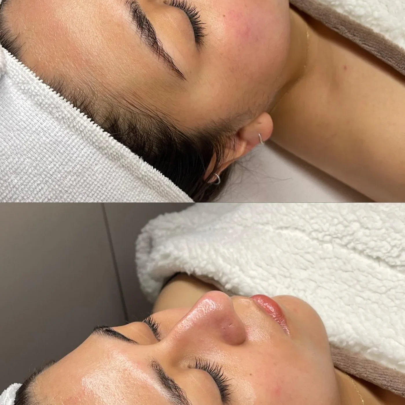 Limpieza facial Glow