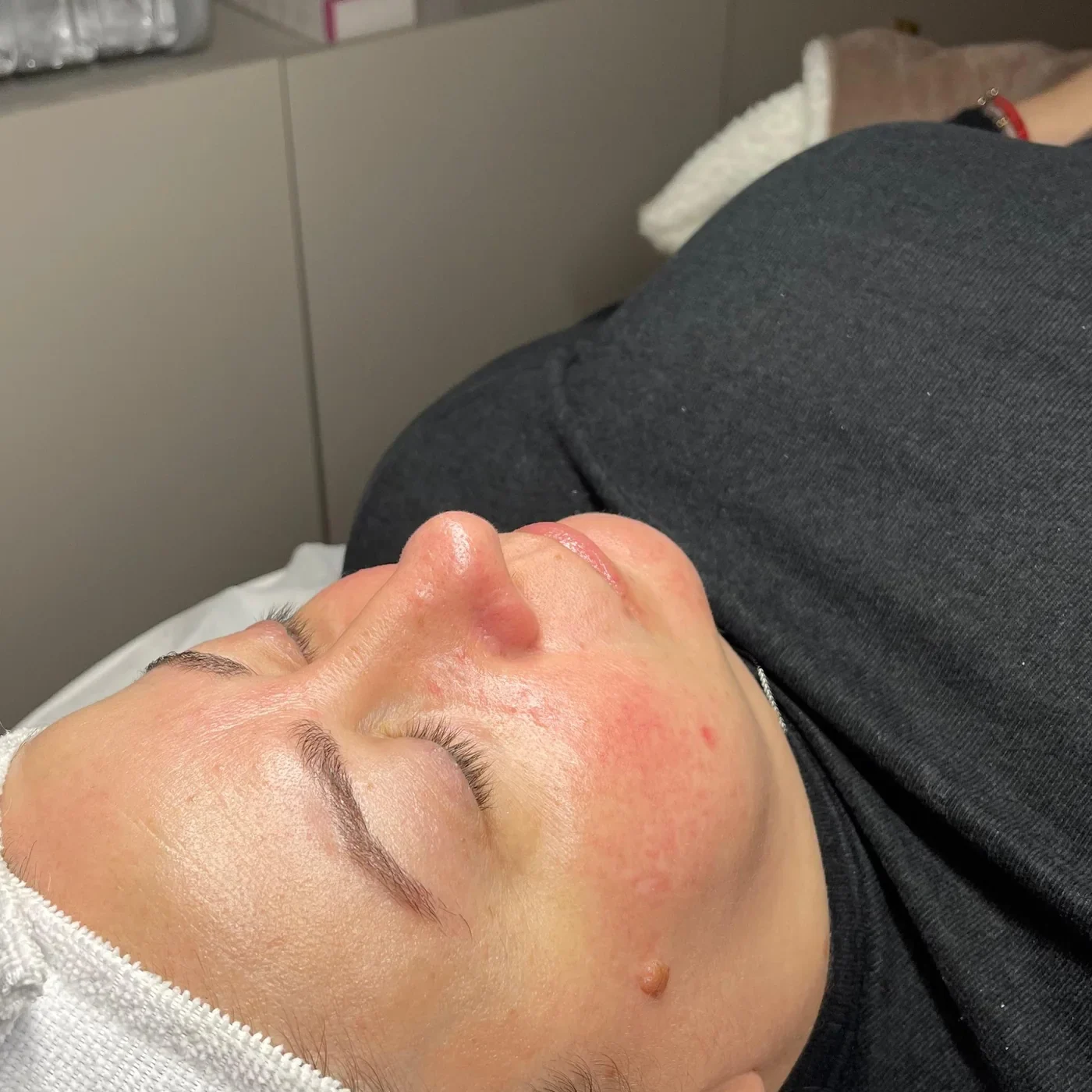 Facial Reparación y Nutrición Intensa