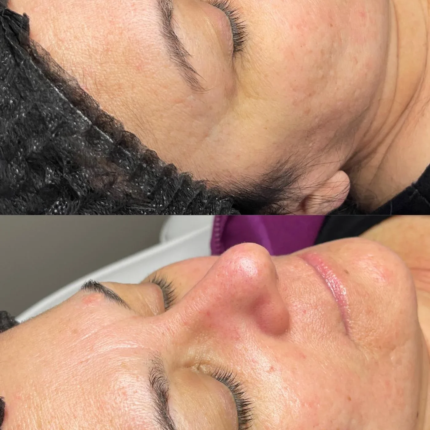 Facial Reparación y Nutrición Intensa