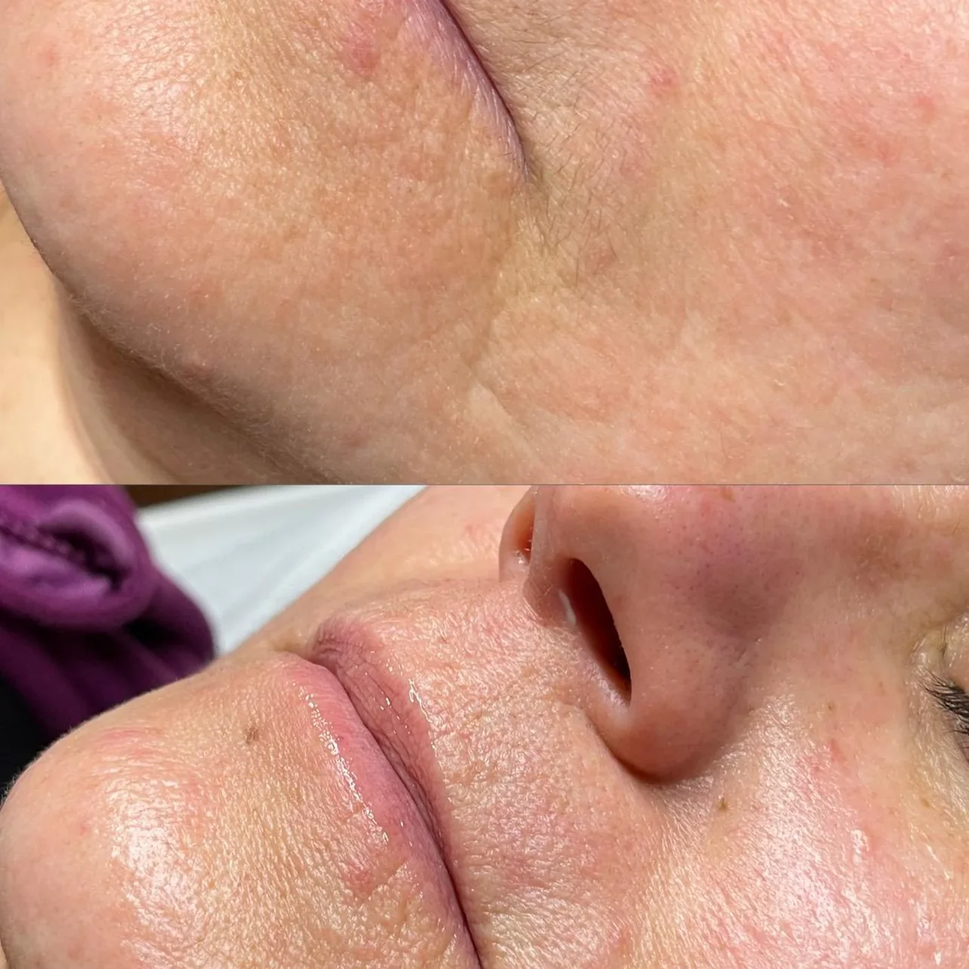 Facial Reparación y Nutrición Intensa