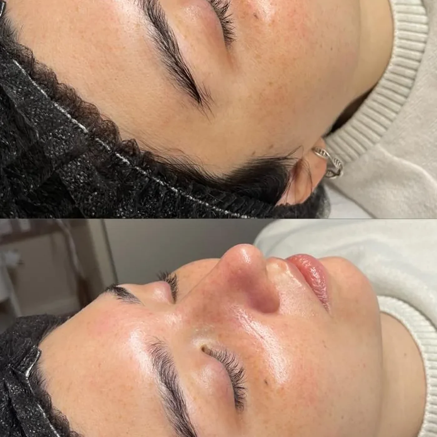Facial Uniformidad del Tono